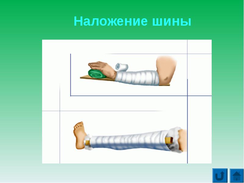 Первая помощь презентация биология 8 класс