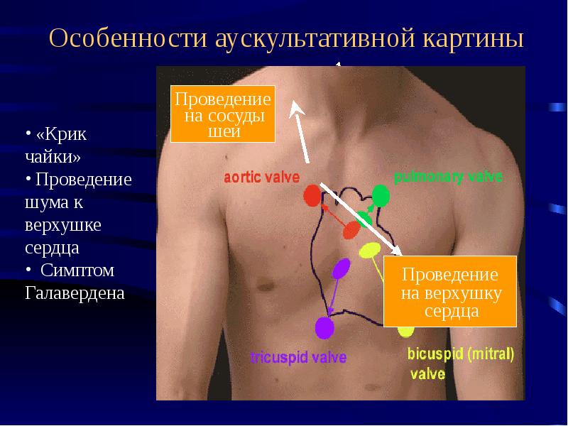 Аускультативная картина. Особенности аускультативной картины сердца. Аускультативная картина на верхушке сердца. Аускультативные синдромы сердца. Особенности аускультативной картины сердца у детей.