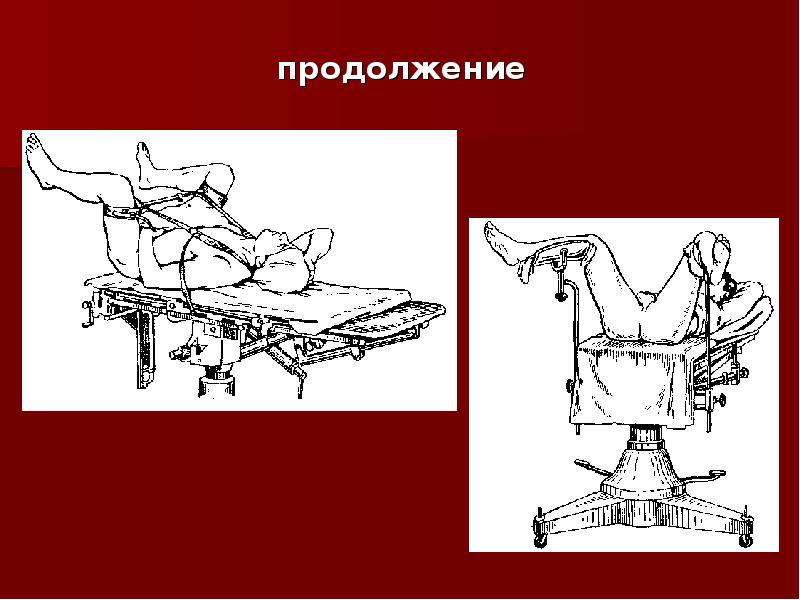 Положение на операционном столе при различных операциях