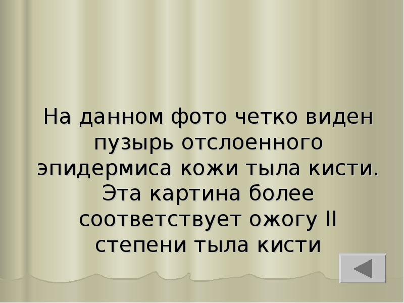 На данном фото четко виден пузырь отслоенного эпидермиса кожи тыла кисти. На данном фото четко виден пузырь отслоенного эпидермиса кожи тыла кисти.