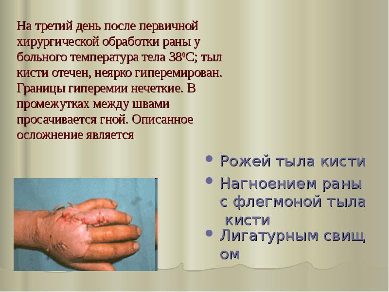 На третий день после первичной хирургической обработки раны у больного температура На третий день после первичной хирургической обработки раны у больного температура