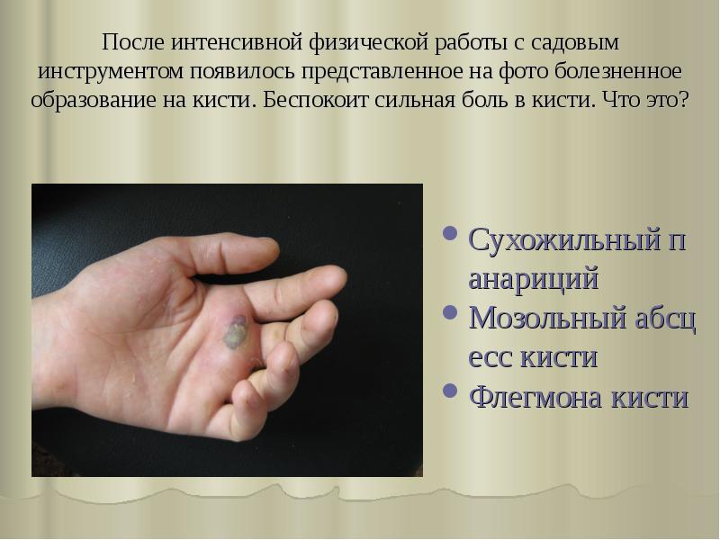 После интенсивной физической работы с садовым инструментом появилось представленное на фото После интенсивной физической работы с садовым инструментом появилось представленное на фото
