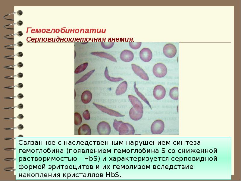 Серповидноклеточная анемия картина крови