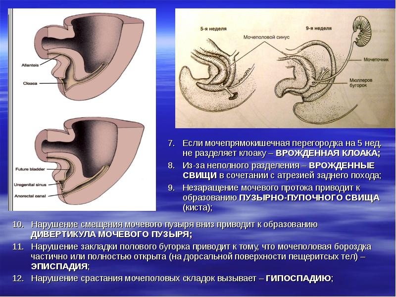 Гипоспадия у детей презентация