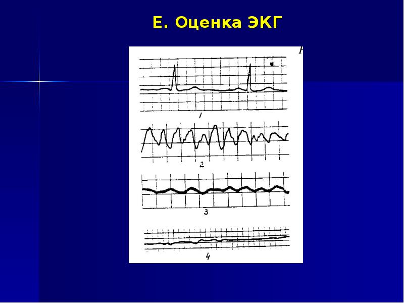 Оценка экг по фото онлайн