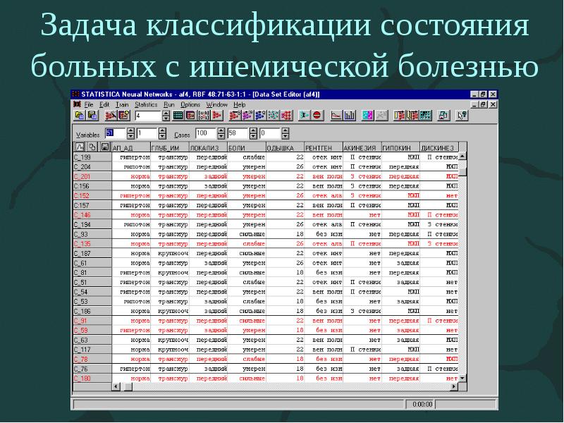 Задача классификации состояния больных с ишемической болезнью Задача классификации состояния больных с ишемической болезнью