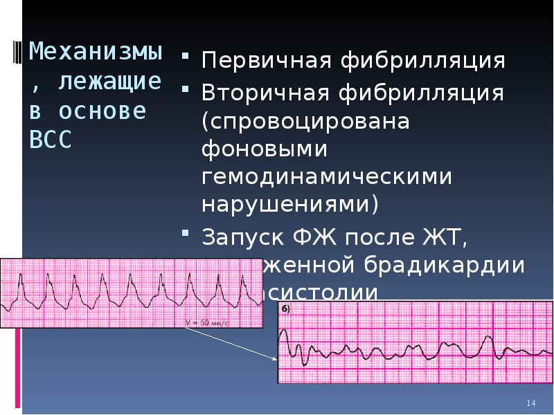 Синдром внезапной сердечной смерти презентации