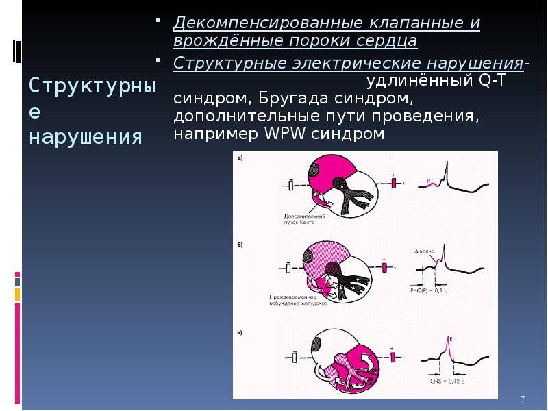 Синдром внезапной сердечной смерти презентации