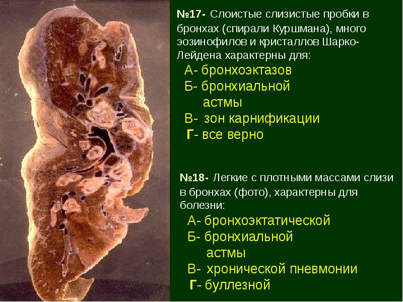 Болезни органов дыхания презентация патанатомия