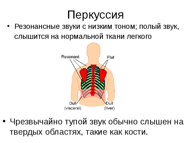 Перкуссия Резонансные звуки с низким тоном; полый звук, слышится на нормальной