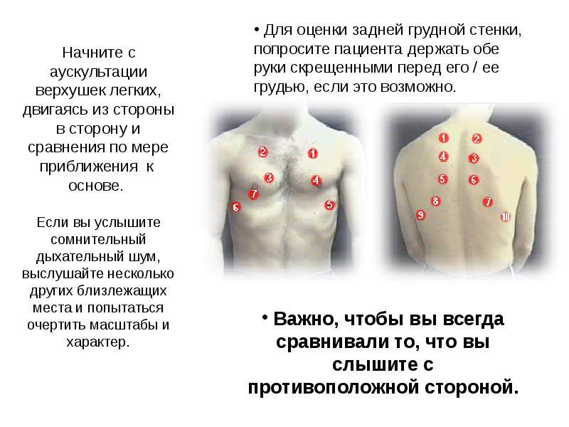 Схема аускультации легких