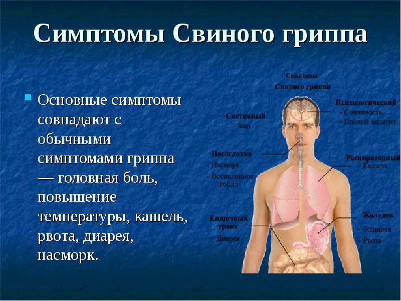 Свиной грипп симптомы. Симптомы св нного гриппа. Спинной грипп симптомы. Основные симптомы гриппа.