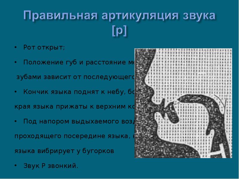 Постановка р при горловом произношении презентация