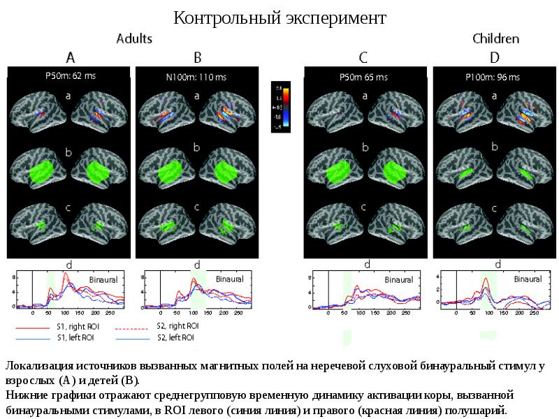 Контрольный опыт. Картирование мозга магнитоэнцефалография. Схема магнитоэнцефалографа. Мэг и ЭЭГ. Магнитоэнцефалография Мэг сущность метода.