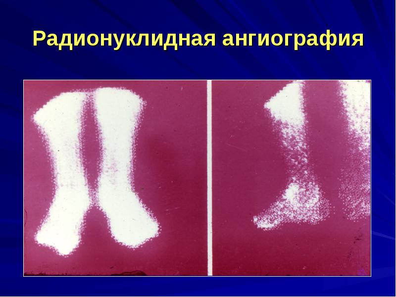 Нарушение периферического кровообращения презентация