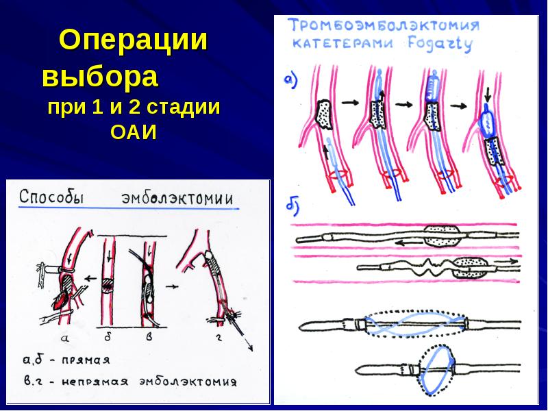 Выберите операцию. Нарушение венозного кровообращения хирургия. Нарушения венозного кровотока хирургия. Нарушения венозного кровообращения общая хирургия.