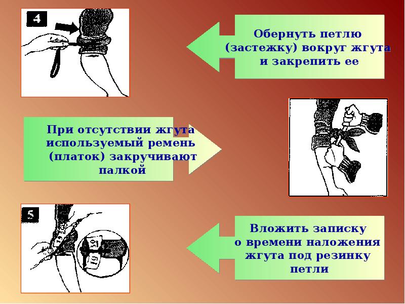 Презентация по обж первая помощь при кровотечениях