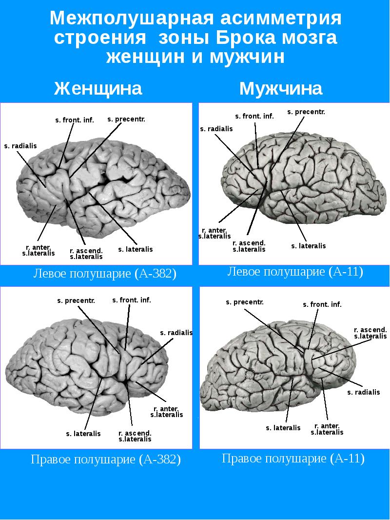 Мозг мужчин различия. Межполушарная асимметрия мозга. Асимметрия полушарий головного мозга. Полушария головного мозга у мужчины. Межполушарная асимметрия анатомия.