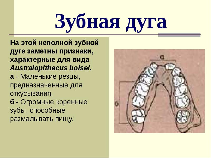 Зубная дуга
На этой неполной зубной дуге заметны признаки, Зубная дуга
На этой неполной зубной дуге заметны признаки,