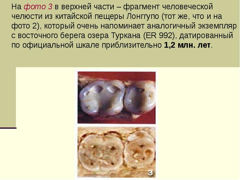 На фото 3 в верхней части – фрагмент человеческой челюсти из На фото 3 в верхней части – фрагмент человеческой челюсти из