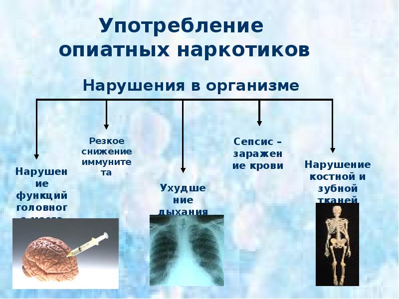 Туберкулез алкоголизм и наркомания презентация