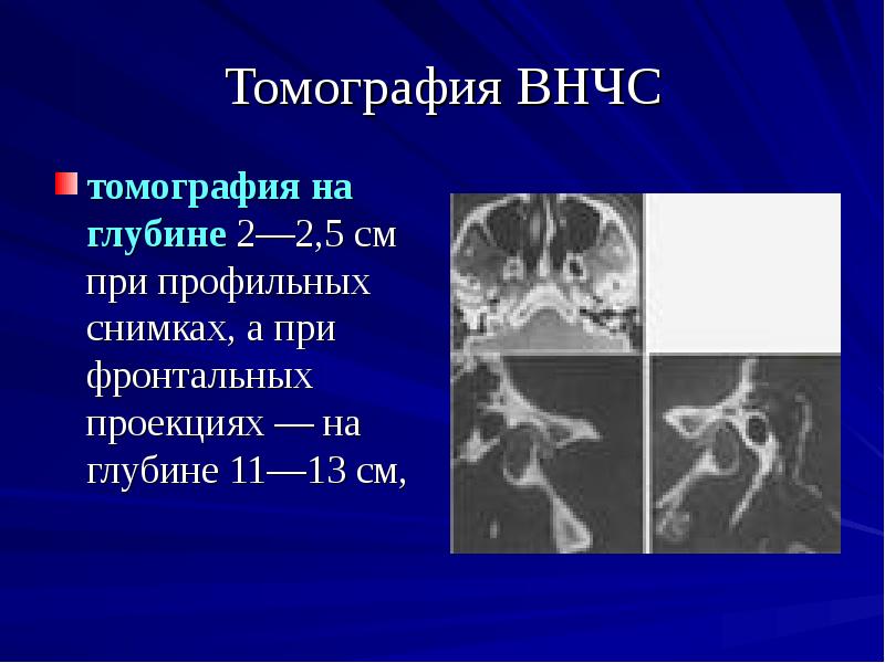 Заболевания височно нижнечелюстного сустава презентация