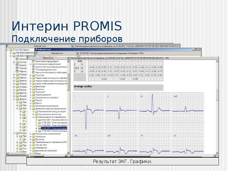 Интерин. Интерин Promis. Интерин система. ЭКГ график. Подсистемы Интерин Promis.