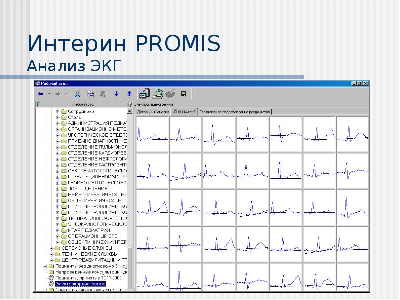 Мис интерин promis презентация