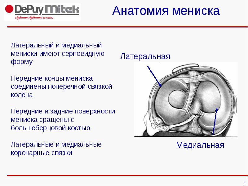 Медиальный рог мениска. Задний Рог латерального и медиального мениска. Передний Рог латерального мениска. Задний Рог латерального мениска. Разрыв латерального и медиального менисков.