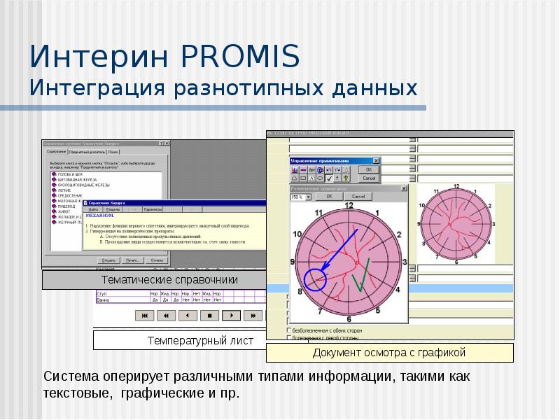 Мис интерин promis презентация