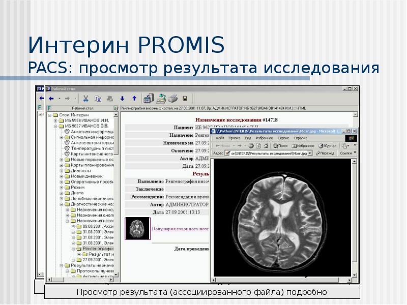 Мис интерин promis презентация