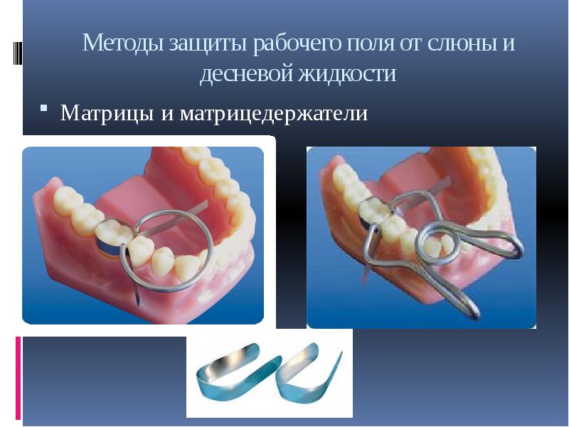 Изоляция рабочего поля матричные системы презентация