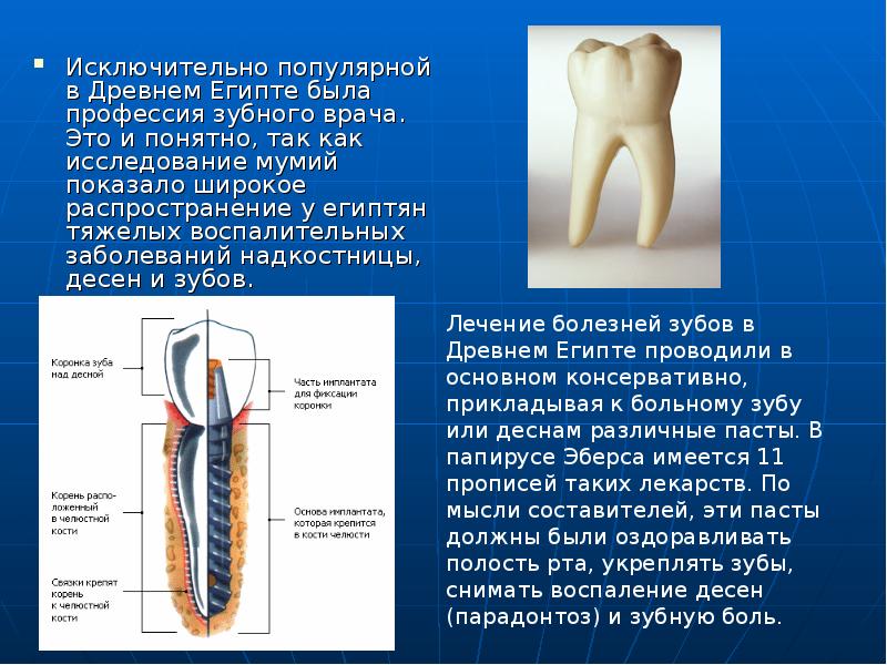 Надкостница зуба картинка