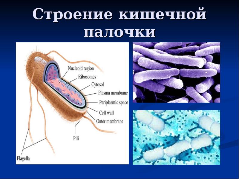 В клетках бактерий есть ядро. Escherichia coli строение. Кишечная палочка строение клетки. Бактерия кишечная палочка строение. Для кишечной палочки e. coli строение.