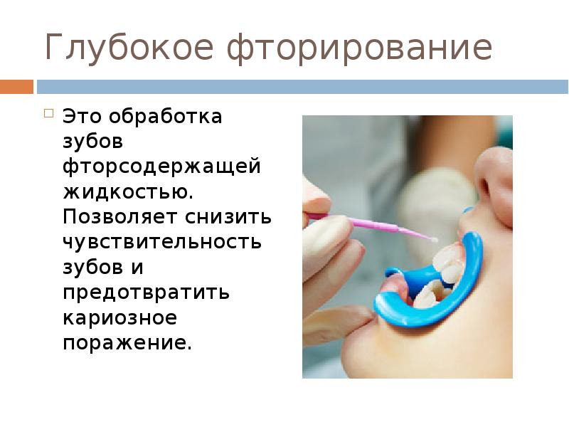 Реминерализация зубов кариес. Фторирование зубов фторлаком. Капа для отбеливания зубов. Капа для зубов реминерализующий. Каппы для реминерализующей терапии.