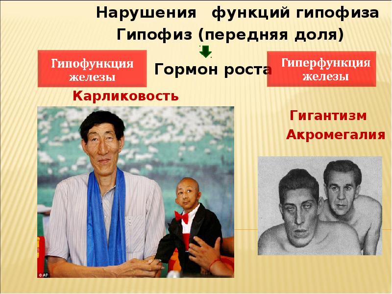 Гормон роста нарушения. Гиперфункция гипофиза заболевания. Соматотропный гормон функции. Избыток и недостаток гормона роста. Гипофизарный нанизм (гипофизарный карликовый рост).