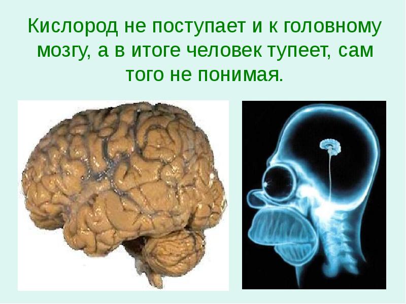 Поступление кислорода в мозг. Кислород не поступает в мозг. Недостаток кислорода в мозге.