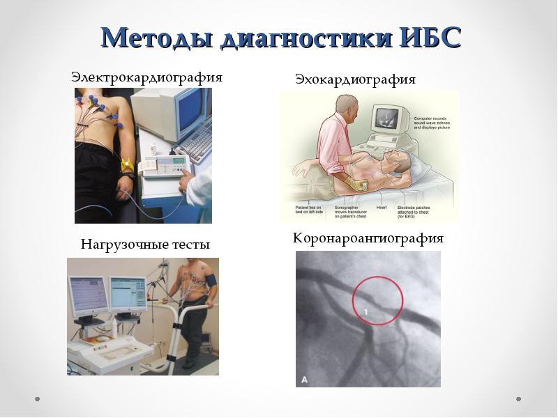 Диагностика ишемии. Метод диагностики ишемической болезни сердца. Инструментальные методы исследования стенокардии. Инструментальные методы диагностики ИБС. Инструментальные методы исследования при ИБС.