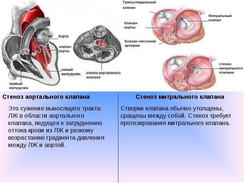 Митральный двухстворчатый. Створок митрального клапана. Трикуспидальный клапан на ЭХОКГ. Трикуспидальный клапан анатомия. Митральный и трехстворчатый клапаны.