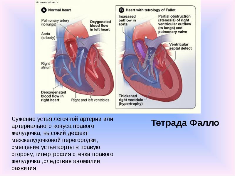 Какая кровь в левом желудочке сердца
