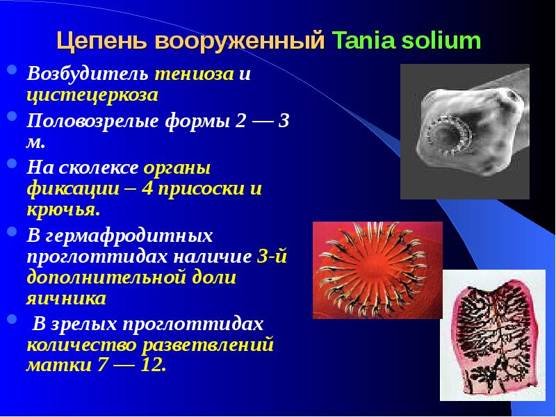 класс ленточные представители бычий цепень. цепней вооруженного. свиной цепень вооруженный. сколексы ленточных червей. Taenia solium органы фиксации.