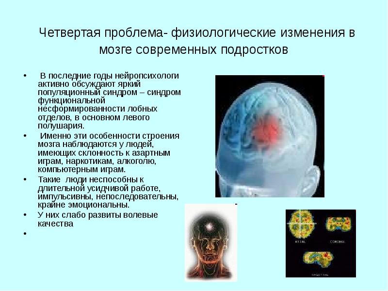 Физиологические проблемы. Дети с несформированностью лобных отделов мозга. Физиологические изменения подростка. Физиологическая проблема человека это.