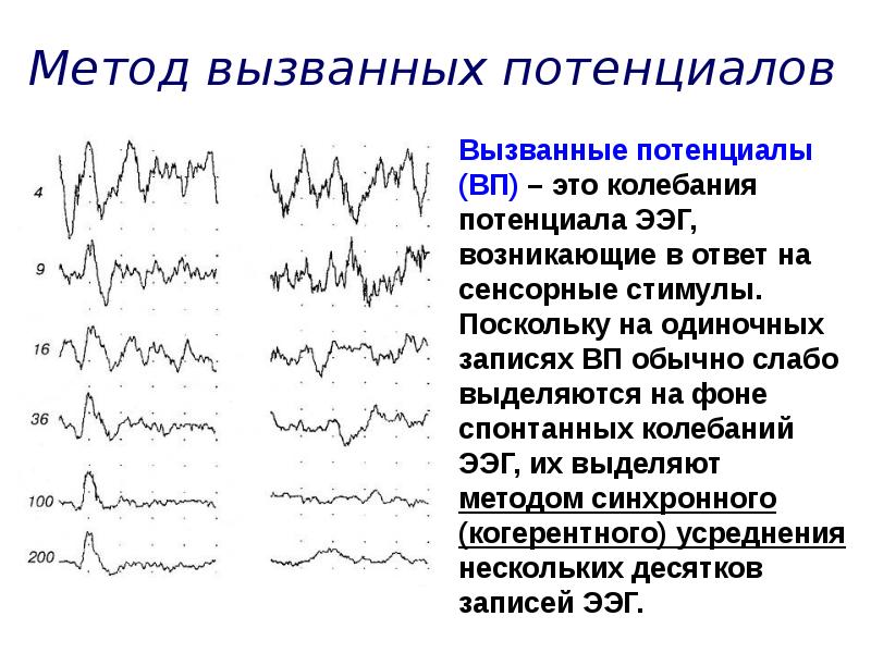 Регистрация слуховых вызванных потенциалов