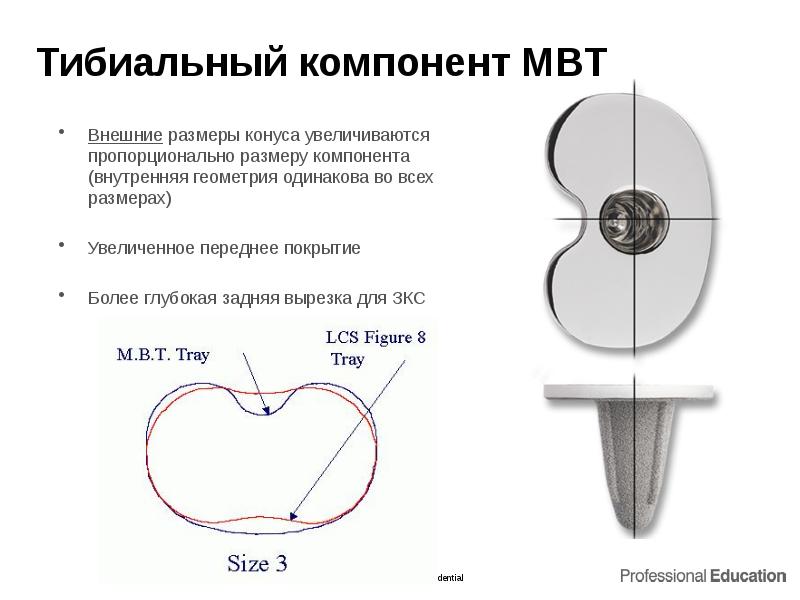 Тибиальный компонент MBT
Внешние размеры конуса увеличиваются пропорционально размеру компонента (внутренняя Тибиальный компонент MBT
Внешние размеры конуса увеличиваются пропорционально размеру компонента (внутренняя