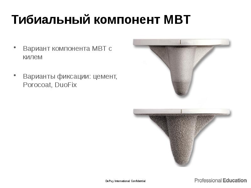 Тибиальный компонент MBT
Вариант компонента MBT с килем
Варианты фиксации: Тибиальный компонент MBT
Вариант компонента MBT с килем
Варианты фиксации: