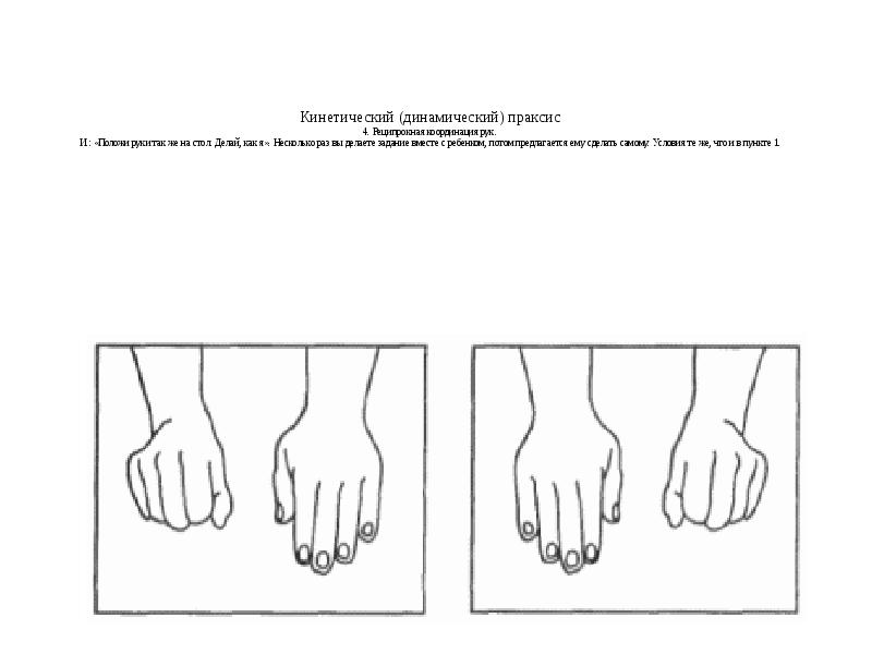 Праксис поз по зрительному образцу