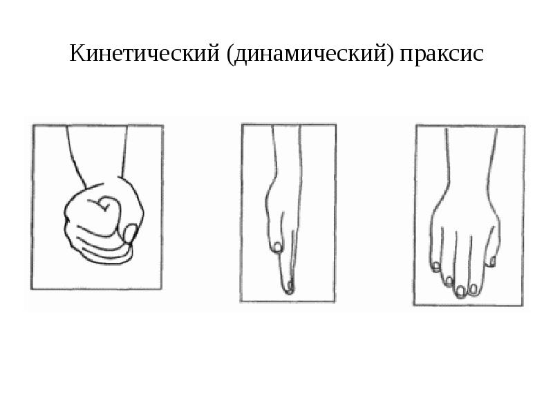 Праксис поз по зрительному образцу