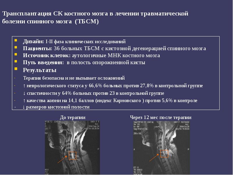 Трансплантация костного мозга презентация