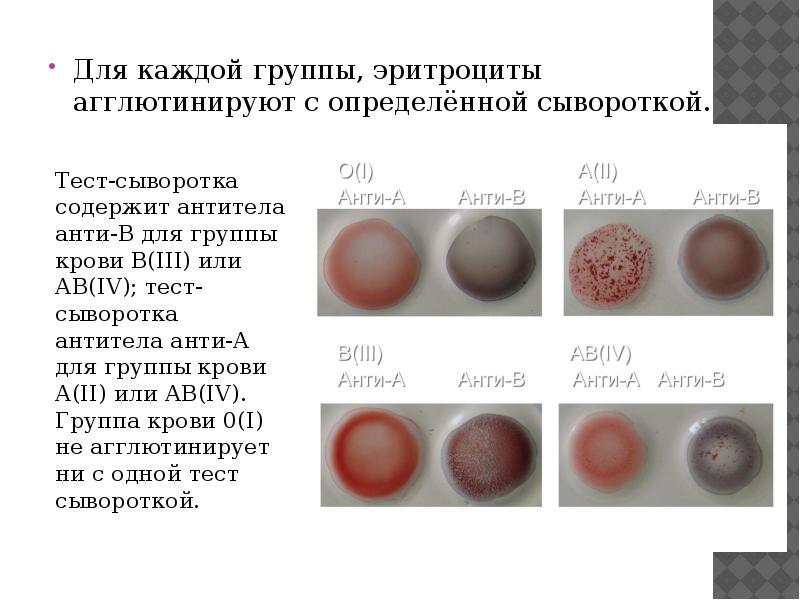 Белки определяющие группу крови. Группы крови эритроциты. Агглютинация эритроцитов. Тест на группу крови. Агглютинирует эритроциты.