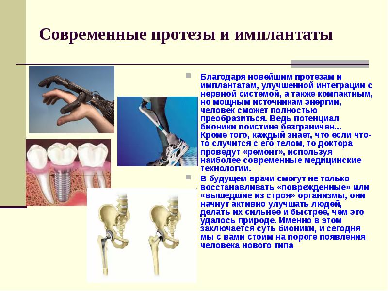 Современные протезы и имплантаты Благодаря новейшим протезам и имплантатам, улучшенной интеграции